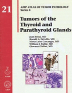 Tumors of the Thyroid and Parathyroid Glands