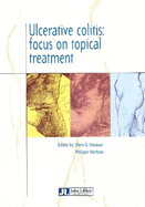 Ulcerative Colitis: Focus on Topical Treatmen
