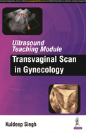 Ultrasound Teaching Module: Transvaginal Scan in Gynecology