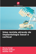 Uma revista atrav?s de implantologia basal e cortical