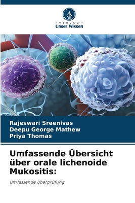 Umfassende ?bersicht ?ber orale lichenoide Mukositis - Sreenivas, Rajeswari, and Mathew, Deepu George, and Thomas, Priya