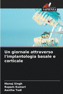 Un giornale attraverso l'implantologia basale e corticale