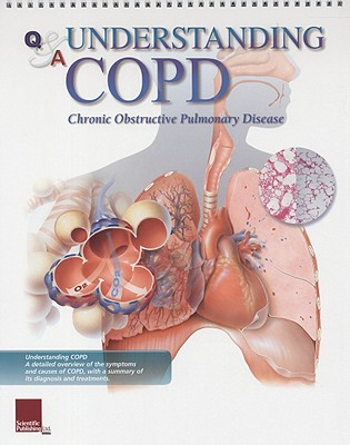 Understanding COPD Flip Chart - Scientific Publishing