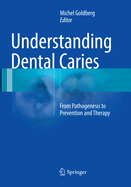 Understanding Dental Caries: From Pathogenesis to Prevention and Therapy