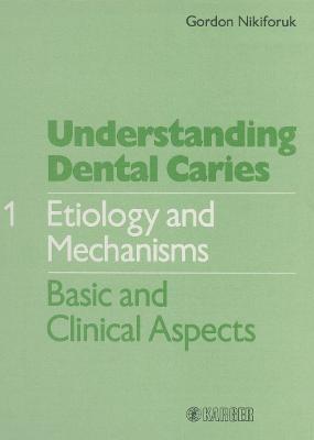 Understanding Dental Caries Vol. 1: Etiology & Mechanisms - Nikiforuk, Gordon