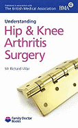 Understanding Hip & Knee Arthritis Surgery