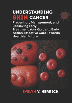 Understanding Skin Cancer: Prevention, Management, and Lifesaving Early Treatment: Your Guide to Early Action, Effective Care Towards Healthier Future - V Herrick, Evelyn