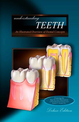 Understanding Teeth - Deluxe Edition: An Illustrated Overview of Dental Concepts - Gordon B a, Stephen F