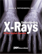 Understanding X-Rays: A Plain English Approach - Rothenberg, Mikel A, MD