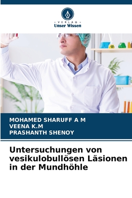 Untersuchungen von vesikulobullsen L?sionen in der Mundhhle - Sharuff, Mohamed, and K M, Veena, and Shenoy, Prashanth