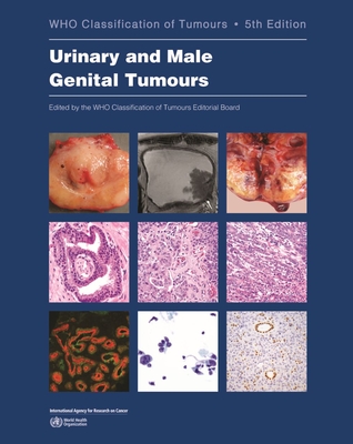 Urinary and Male Genital Tumours - Who Classification of Tumours Editorial Board (Editor)