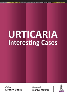 Urticaria: Interesting Cases - Godse, Kiran V