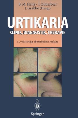 Urtikaria: Klinik, Diagnostik, Therapie - Henz, Beate M (Editor), and Zuberbier, T (Editor), and Grabbe, J?rgen (Editor)