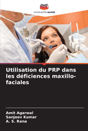 Utilisation du PRP dans les d?ficiences maxillo-faciales