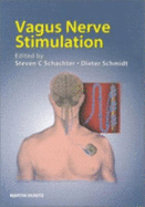 Vagus nerve stimulation