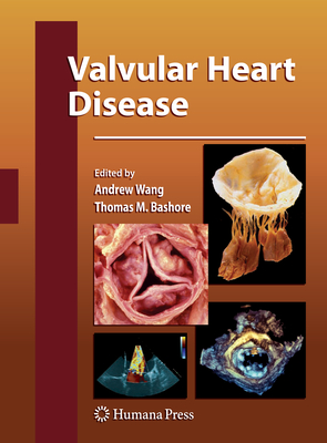 Valvular Heart Disease - Wang, Andrew (Editor), and Bashore, Thomas M (Editor)
