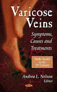Varicose Veins: Symptoms, Causes, and Treatments