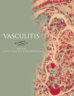 Vasculitis - Ball, Gene V (Editor), and Bridges, S Louis, Jr. (Editor)