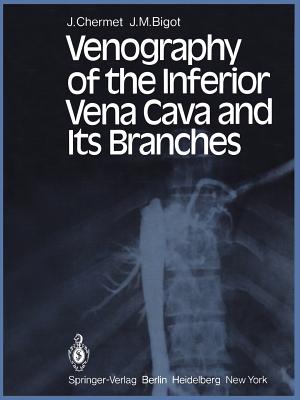 Venography of the Inferior Vena Cava and Its Branches - Chermet, J, and Wackenheim, M T (Translated by), and Bigot, J M