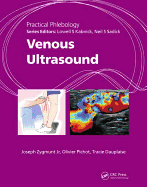 Venous Ultrasound