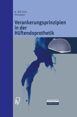 Verankerungsprinzipien in Der Ha1/4ftendoprothetik - Wetzel, Roland (Editor)
