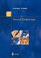 Virtual Endoscopy