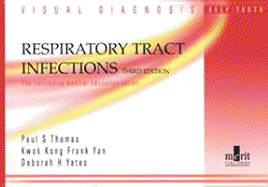 Visual Diagnosis Self-Tests on Respiratory Tract Infections - Thomas, Paul S