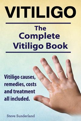 Vitiligo. Vitiligo causes, remedies, costs and treatment all included. The complete Vitiligo Book. - Sunderland, Steve