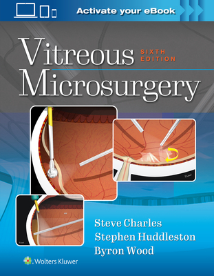 Vitreous Microsurgery - Charles, Steve, MD