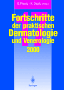 Vortrage Und Dia-Klinik Der 17. Fortbildungswoche 2000 Fortbildungswoche Fa1/4r Praktische Dermatologie Und Venerologie E.V. C/O Klinik Und Poliklinik Fa1/4r Dermatologie Und Allergologie Ludwig-Maximilians-Universitat Ma1/4nchen Inverbindung Mit Dem Ber