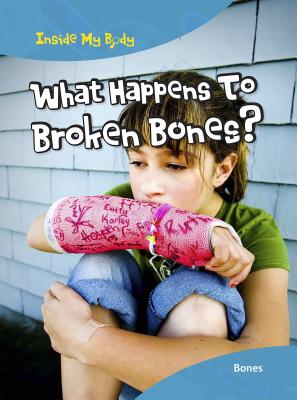 What Happens to Broken Bones?: Bones - Ballard, Carol, Dr.