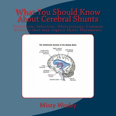 What You Should Know About Cerebral Shunts: Definition, Infection, Obstructions, Common Diseases that may require Shunt Placements - Wesley, Misty Lynn