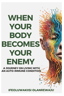 When Your Body Becomes Your Enemy: A Journey on Living with an Auto-Immune Condition.