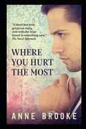 Where You Hurt The Most