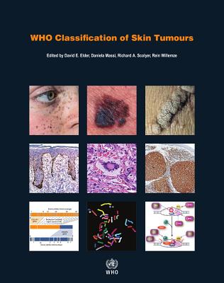 Who Classification of Skin Tumours - Who Classification of Tumours Editorial Board (Editor), and Massi, D (Editor), and Scolyer, R (Editor)