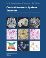 WHO classification of tumours of the central nervous system