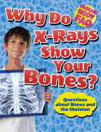 Why Do X-Rays Show Your Bones?: Questions about Bones and the Skeleton