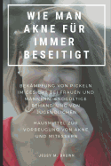 Wie Man Akne F?r Immer Beseitigt: Bek?mpfung Von Pickeln Im Gesicht Bei Frauen Und M?nnern, Endg?ltige Behandlung Von Jugendlichen Hausmittel Zur Vorbeugung Von Akne Und Mitessern