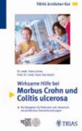 Wirksame Hilfe Bei Morbus Crohn Und Colitis Ulcerosa
