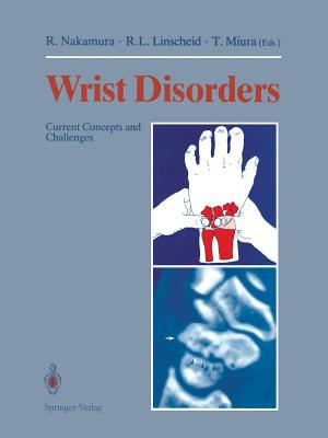 Wrist Disorders: Current Concepts and Challenges - Nakamura, Ryogo (Editor), and Linscheid, Ronald L (Editor), and Miura, Takayuki (Editor)