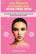 you deserve a smooth and acne free skin: a simple guide on how to get rid of acne