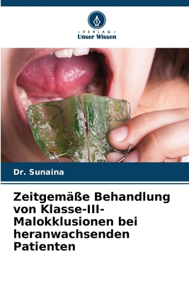 Zeitgem??e Behandlung von Klasse-III-Malokklusionen bei heranwachsenden Patienten - Sunaina, Dr.