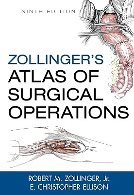 Zollinger's Atlas of Surgical Operations, Ninth Edition - Zollinger, Robert M, and Zollinger, Jr, and Ellison E